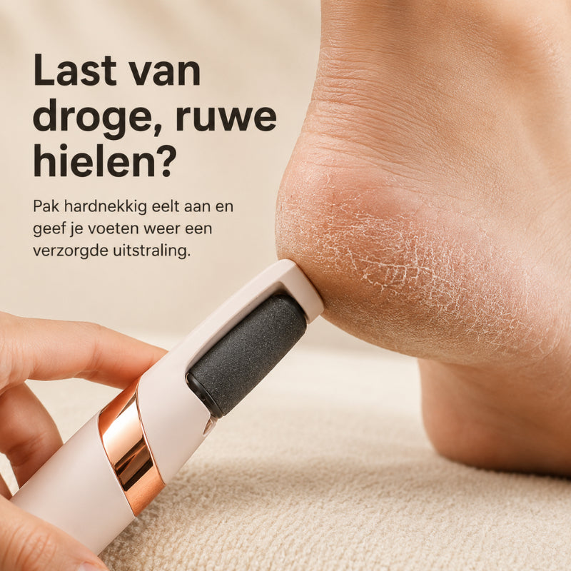 🔥LAST DAY SALE - BUY 1 GET 1 FREE!!⚡Effectively remove dry skin & calluses!